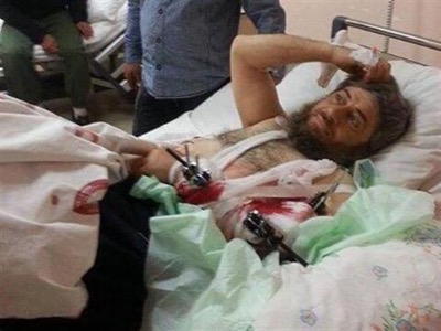 On the 16th April 2014, the Turkish press published a photographe of Abu Muhammad, one of Daesh’s superior officers, who had been wounded by the Syrian Arab Army in Idleb, then transferred to Turkey by the MIT (Turkish Intelligence Agency) and cared for at the expense of Turkish tax-payers at the public hospital in Hatay. 