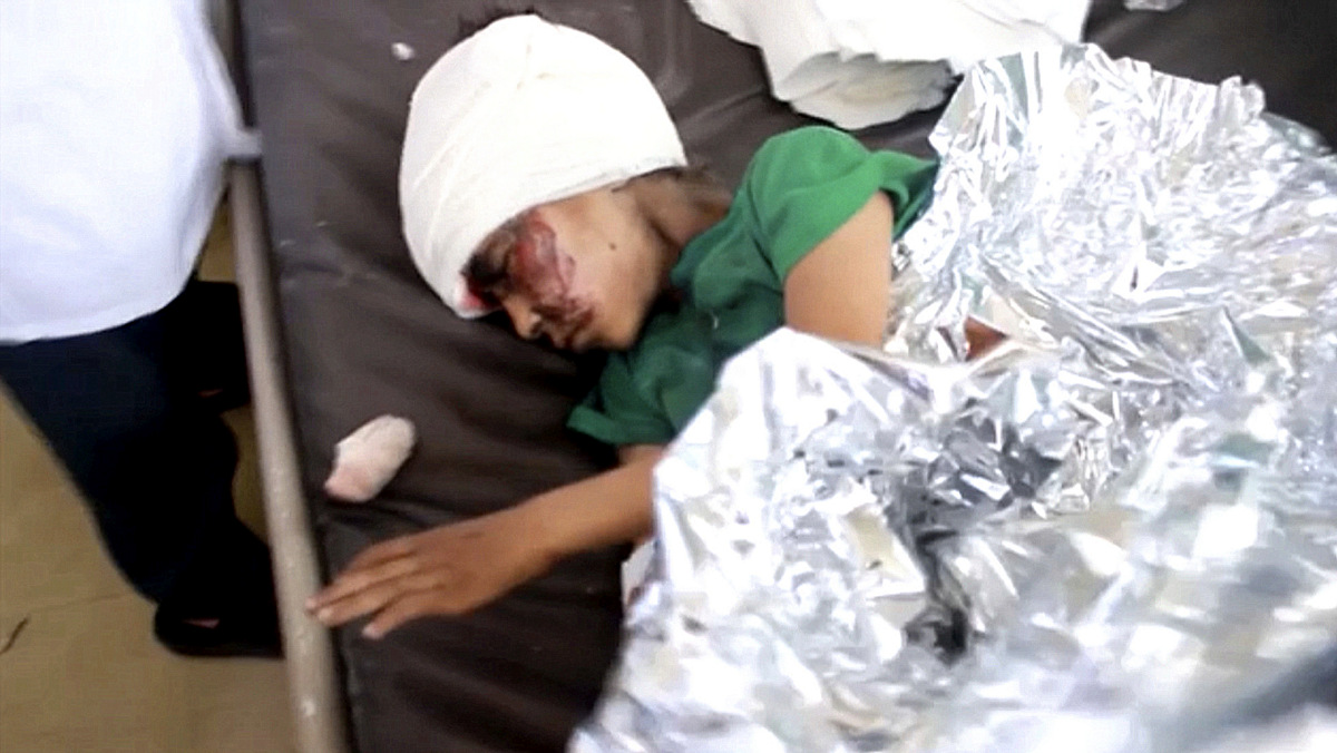 Watch | Exclusive Look inside Saudi Arabia’s Strike On School Bus In Yemen, 50+ Killed