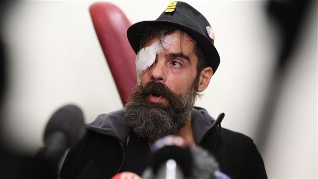 Gilets jaunes leader hit in eye during protest ‘will be disabled for life’