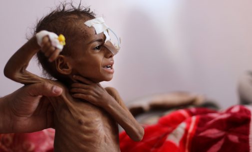 This Is Yemen After Biden Declared an End To American Support for the War